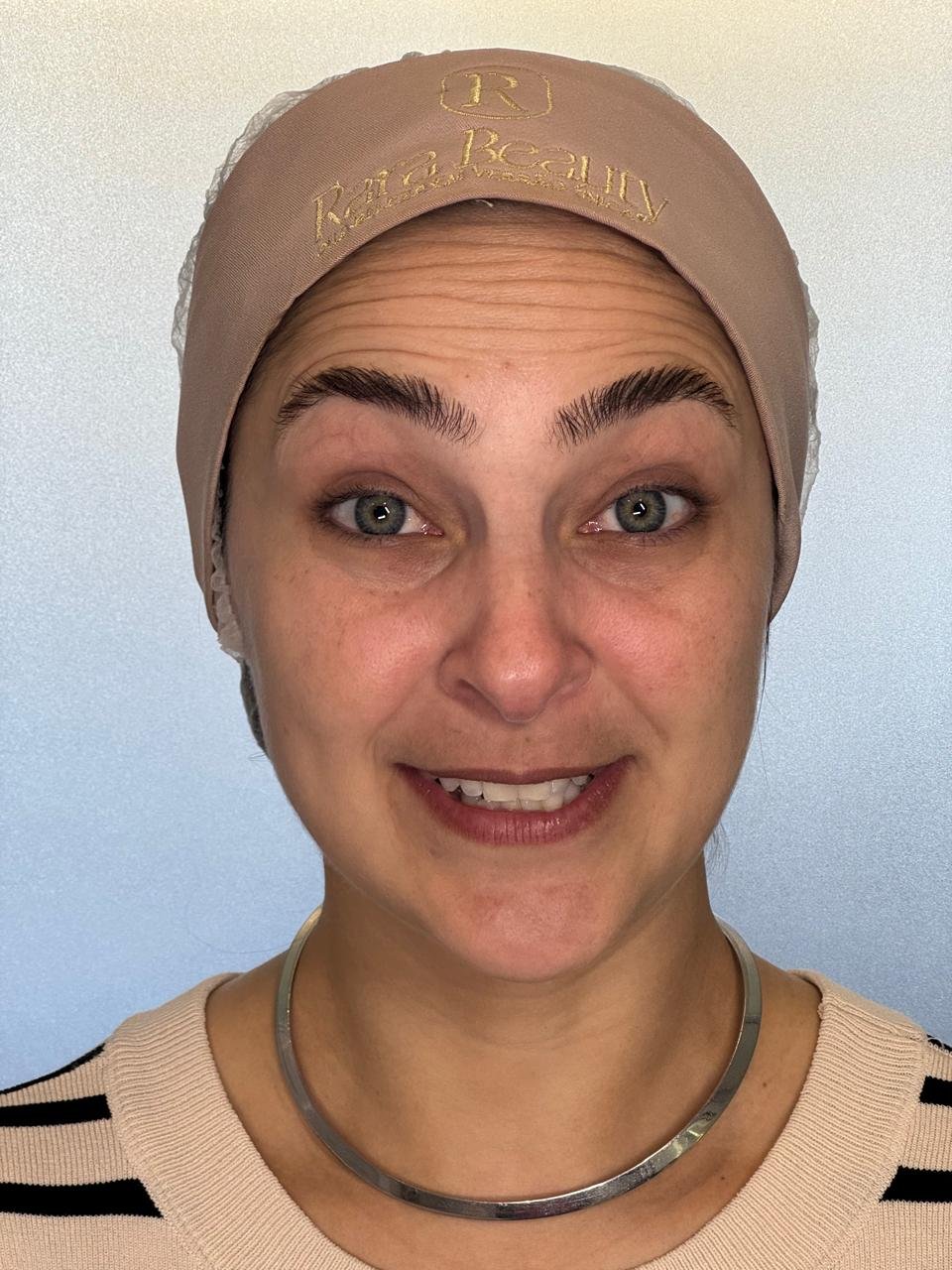 Antes do Procedimento